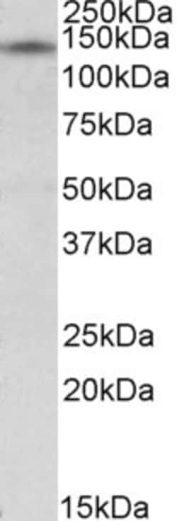 Invitrogen RIP140 Polyclonal Antibody 100 &mu;g; Unconjugated:Antibodies,