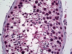 Invitrogen PREX1 Polyclonal Antibody 100 &mu;g; Unconjugated:Antibodies,