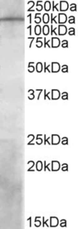 Invitrogen PREX1 Polyclonal Antibody 100 &mu;g; Unconjugated:Antibodies,