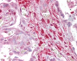Invitrogen Calponin 2 Polyclonal Antibody 100 &mu;g; Unconjugated:Antibodies,