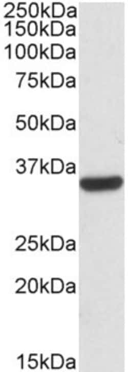 Invitrogen Calponin 2 Polyclonal Antibody 100 &mu;g; Unconjugated:Antibodies,