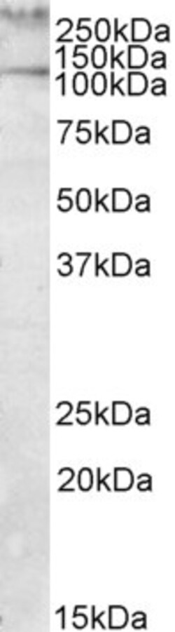 Invitrogen Talin 1 Polyclonal Antibody 100 &mu;g; Unconjugated:Antibodies,