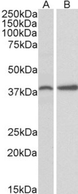Invitrogen PRKCDBP Polyclonal Antibody 100 &mu;g; Unconjugated:Antibodies,