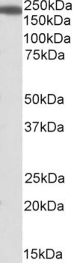 Invitrogen IQGAP1 Polyclonal Antibody 100 &mu;g; Unconjugated:Antibodies,