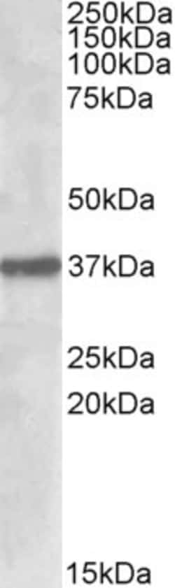Invitrogen SUMF1 Polyclonal Antibody 100 &mu;g; Unconjugated:Antibodies,