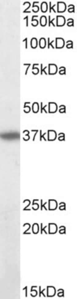 Invitrogen FAS Polyclonal Antibody 100 &mu;g | Buy Online | Invitrogen&trade; | Fisher Scientific