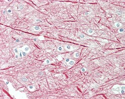 Invitrogen NEFM Polyclonal Antibody 100 &mu;g; Unconjugated:Antibodies,