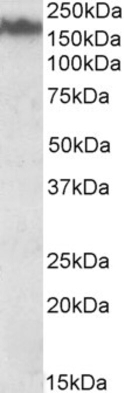 Invitrogen NEFM Polyclonal Antibody 100 &mu;g; Unconjugated:Antibodies,