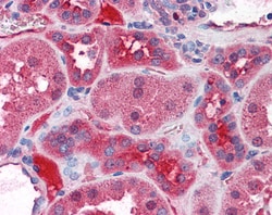 Invitrogen KCNN2 Polyclonal Antibody 100 &mu;g; Unconjugated:Antibodies,