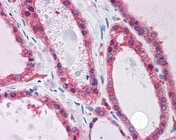 Invitrogen KCNN2 Polyclonal Antibody 100 &mu;g; Unconjugated:Antibodies,