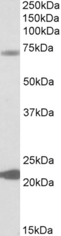 Invitrogen KCNN2 Polyclonal Antibody 100 &mu;g; Unconjugated:Antibodies,