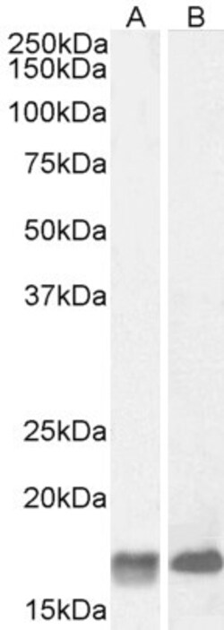 GAL Polyclonal Antibody, Invitrogen 100 &mu;g; Unconjugated:Antibodies,