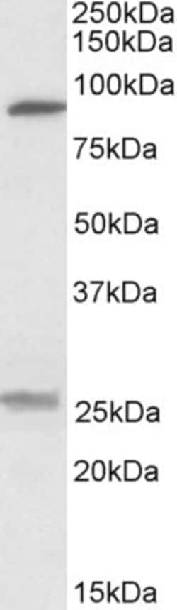 Invitrogen SLC4A11 Polyclonal Antibody 100 &mu;g; Unconjugated:Antibodies,