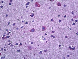 Invitrogen Prokineticin Receptor 2 Polyclonal Antibody 100 &mu;g; Unconjugated:Antibodies,