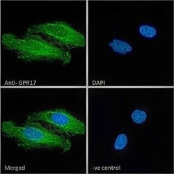 Invitrogen GPR17 Polyclonal Antibody 100 &mu;g; Unconjugated:Antibodies,