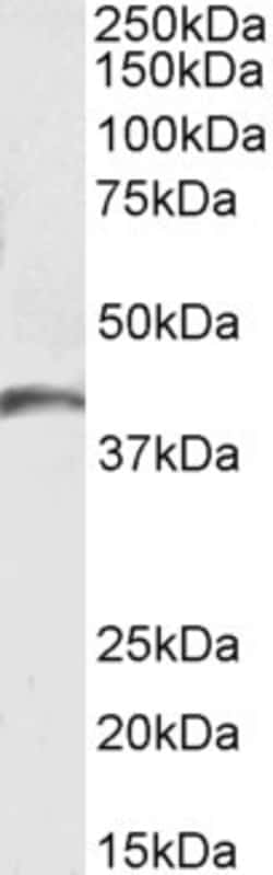 Invitrogen GPR17 Polyclonal Antibody 100 &mu;g; Unconjugated:Antibodies,