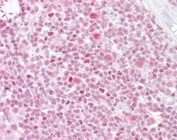 Invitrogen IKAROS Polyclonal Antibody 100 μg; Unconjugated:Antibodies,