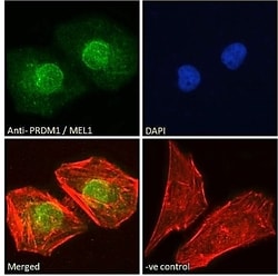 Invitrogen Blimp-1 Polyclonal Antibody 100 &mu;g; Unconjugated:Antibodies,