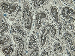 Invitrogen Blimp-1 Polyclonal Antibody 100 &mu;g; Unconjugated:Antibodies,