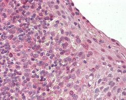 Invitrogen Blimp-1 Polyclonal Antibody 100 &mu;g; Unconjugated:Antibodies,