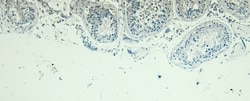 Invitrogen Blimp-1 Polyclonal Antibody 100 &mu;g; Unconjugated:Antibodies,