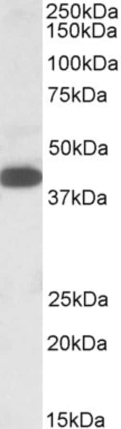 Invitrogen A4GNT Polyclonal Antibody 100 &mu;g; Unconjugated:Antibodies,