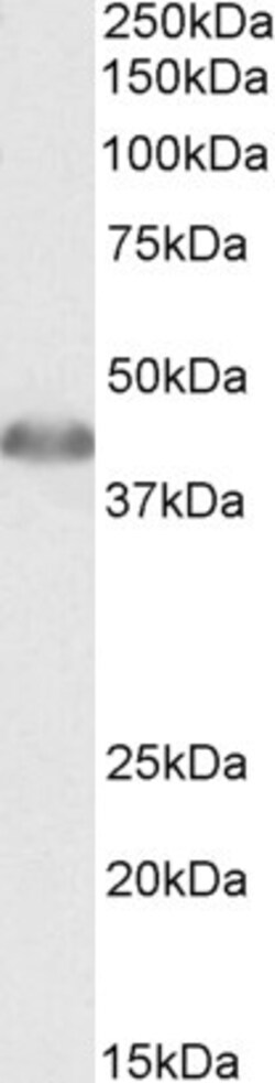 Invitrogen ACAT1 Polyclonal Antibody 100 &mu;g; Unconjugated:Antibodies,