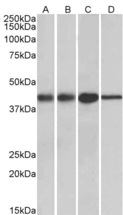 Invitrogen ACAT1 Polyclonal Antibody 100 &mu;g; Unconjugated:Antibodies,