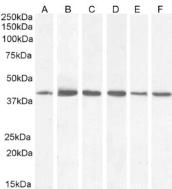 Invitrogen ACAT1 Polyclonal Antibody 100 &mu;g; Unconjugated:Antibodies,