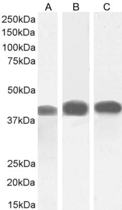 Invitrogen ACAT1 Polyclonal Antibody 100 &mu;g; Unconjugated:Antibodies,