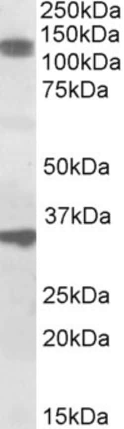 Invitrogen CCAR1 Polyclonal Antibody 100 μg; Unconjugated:Antibodies,