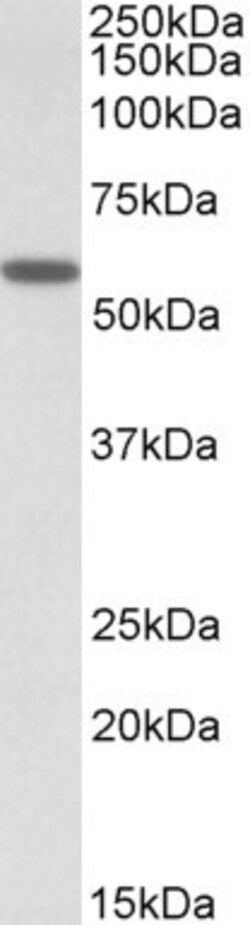 Invitrogen DIXDC1 Polyclonal Antibody 100 &mu;g; Unconjugated:Antibodies,