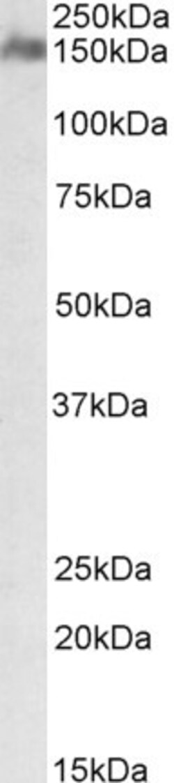 CSMD1 Polyclonal Antibody, Invitrogen 100 &mu;g; Unconjugated:Antibodies,
