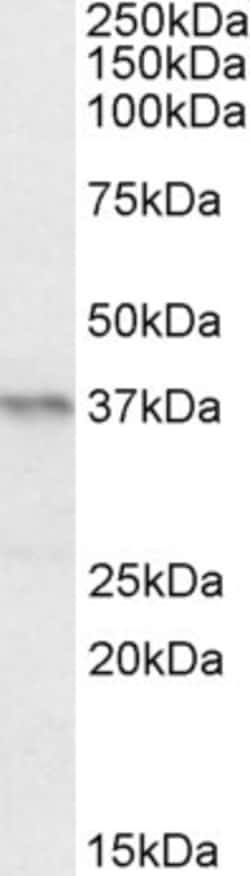 Invitrogen PAX4 Polyclonal Antibody 100 &mu;g; Unconjugated:Antibodies,