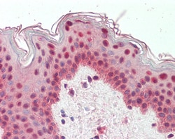 Invitrogen TIA1/TIAL1 Polyclonal Antibody 100 &mu;g; Unconjugated:Antibodies,