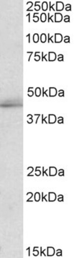 Invitrogen TIA1/TIAL1 Polyclonal Antibody 100 &mu;g; Unconjugated:Antibodies,