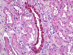Invitrogen TGFBI Polyclonal Antibody 100 &mu;g; Unconjugated:Antibodies,