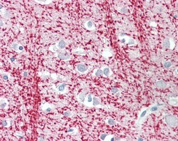 Invitrogen TPPP Polyclonal Antibody 100 &mu;g | Buy Online | Invitrogen&trade; | Fisher Scientific