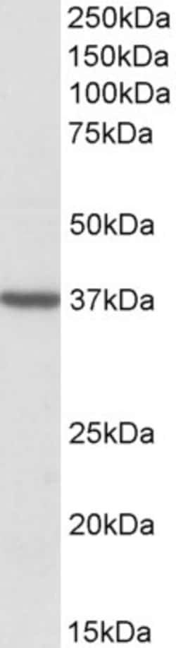 Invitrogen TOMM40 Polyclonal Antibody 100 &mu;g; Unconjugated:Antibodies,