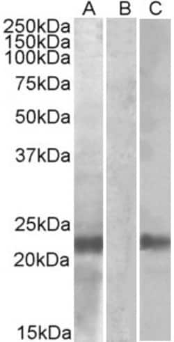 Invitrogen Cystatin 8 Polyclonal Antibody 100 &mu;g; Unconjugated:Antibodies,