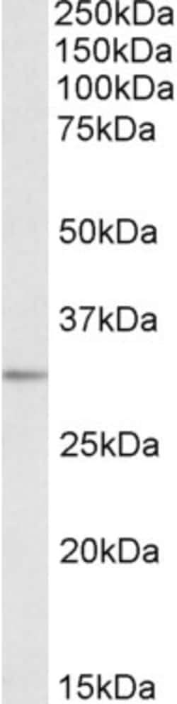 Invitrogen MAPRE3 Polyclonal Antibody 100 &mu;g; Unconjugated:Antibodies,