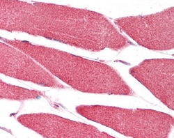 Invitrogen CHCHD3 Polyclonal Antibody 100 μg; Unconjugated:Antibodies,