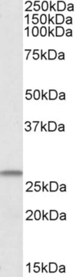 Invitrogen CHCHD3 Polyclonal Antibody 100 μg; Unconjugated:Antibodies,