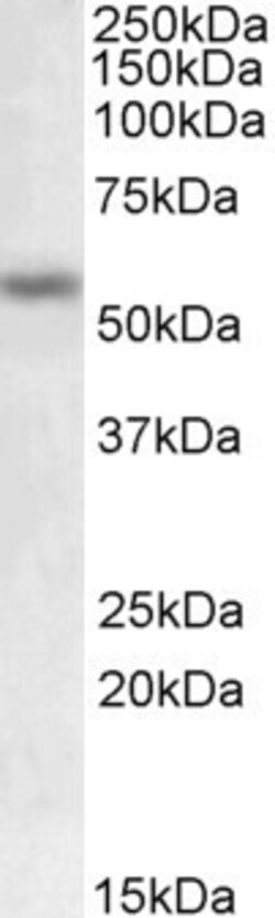 Invitrogen MMP12 Polyclonal Antibody 100 &mu;g; Unconjugated:Antibodies,