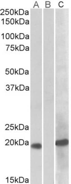 Invitrogen HOXA1 Polyclonal Antibody 100 μg; Unconjugated:Antibodies,