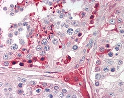 Invitrogen CRISP2 Polyclonal Antibody 100 &mu;g; Unconjugated:Antibodies,
