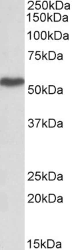 Invitrogen LSP1 Polyclonal Antibody 100 &mu;g; Unconjugated:Antibodies,