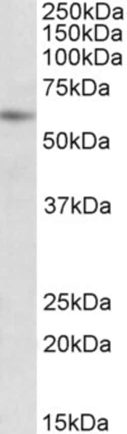 Invitrogen PIAS2 Polyclonal Antibody 100 &mu;g; Unconjugated:Antibodies,