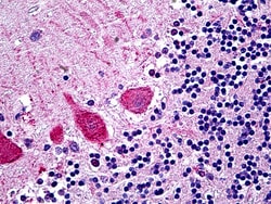 Invitrogen TRIM71 Polyclonal Antibody 100 &mu;g; Unconjugated:Antibodies,