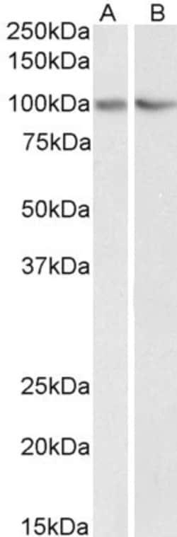 Invitrogen TRIM71 Polyclonal Antibody 100 &mu;g; Unconjugated:Antibodies,